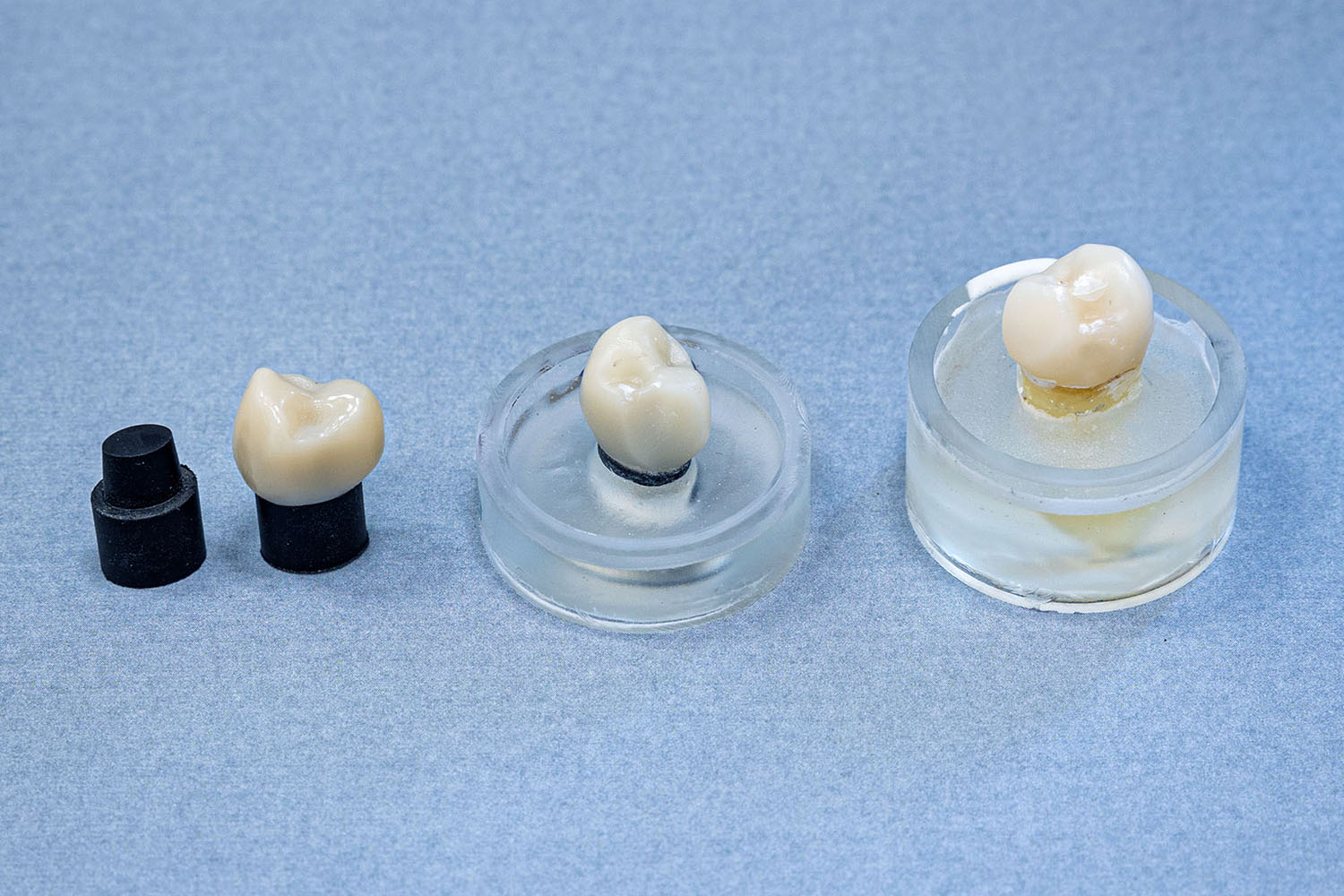 HKU Faculty of Dentistry, Dentine analogue material substrate compared with extracted human teeth in ceramic crown