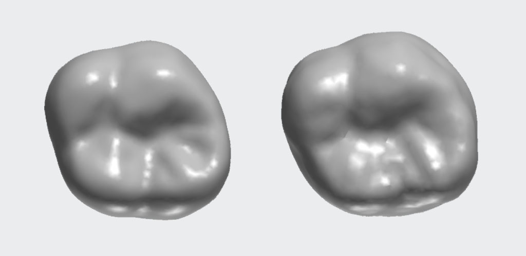 HKU Faculty of Dentistry, Core Technologies using Generative AI in Smart Manufacturing of Dental Crowns