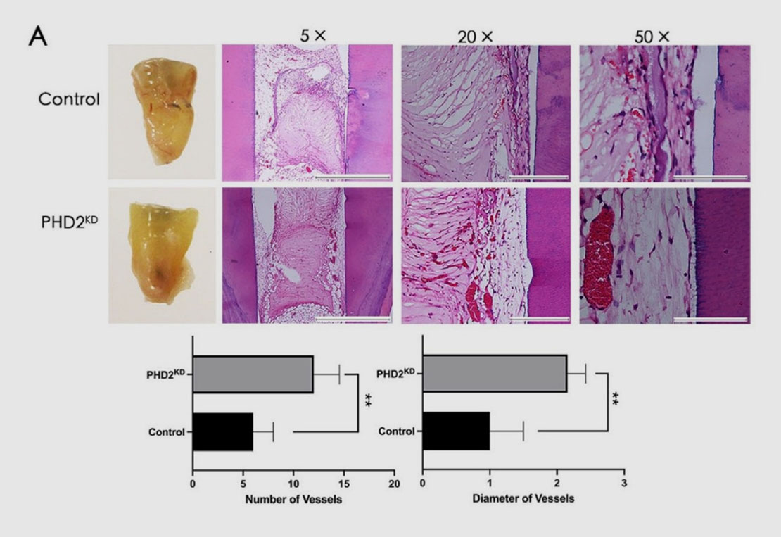Positive Stress to Boost Tooth Tissue Regeneration